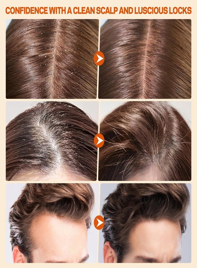 AMOADO Scalp Scrub, Pumpkin Seed Oil Scalp Exfoliator With Biotin & Rosemary, Sulfate Free Scalp Detox for Itchy Scalp & Dandruff & Buildup Removal & Hair Growth, Hair Scrub with Scrubber - Image 4